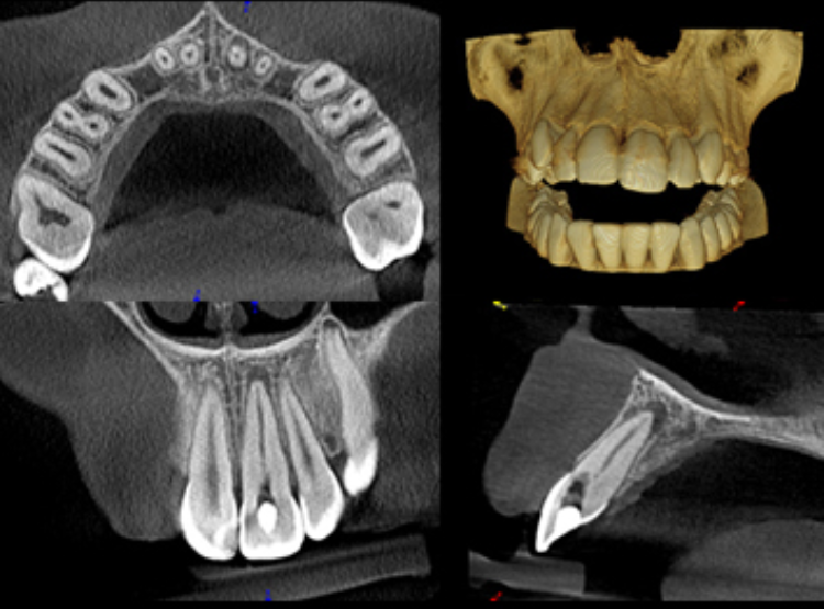3D Imaging Lenexa KS Cone Beam CT Scan Johnson County