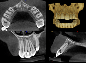 xray of teeth